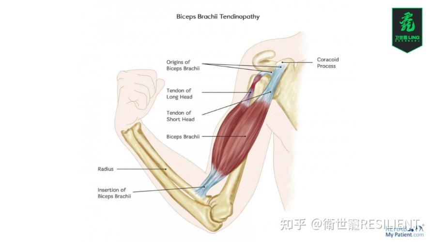 toned biceps,Toned Biceps: A Comprehensive Guide to Achieving Your Dream Arms